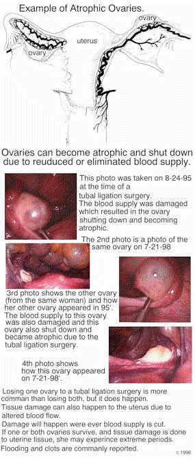 Blood supply to the ovary and uterus